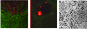Example correlative microscopy images (neurons from a mouse model of Pelizaeus Merzbacher disease). Left: confocal image; middle: zoom-in on red area; right: electron microscopy image. Analyzing data jointly requires the spatial alignment of different microscopy modalities with highly different image appearance.