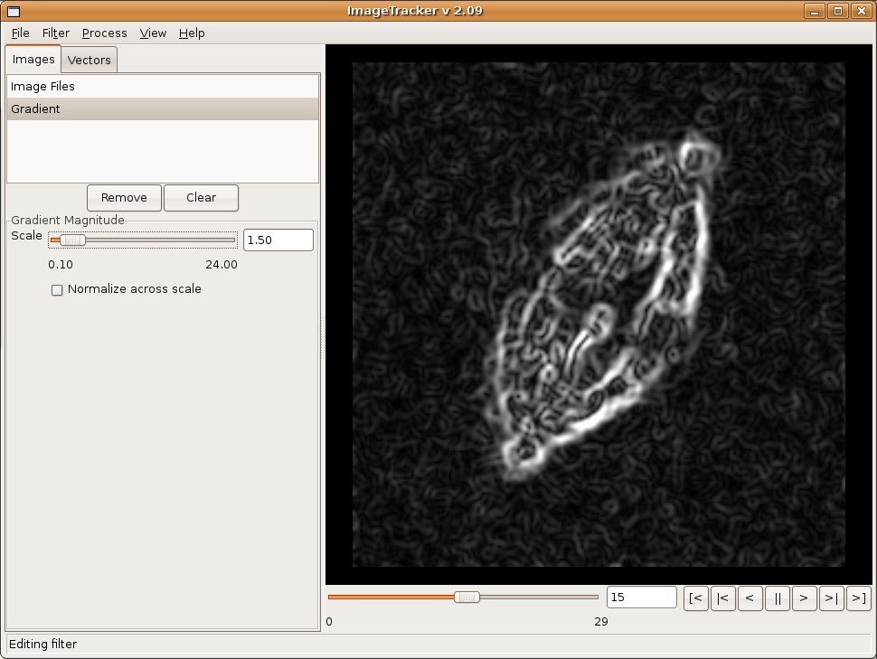 A fluorescence microscopy image of a mitotic spindle with a gradient magnitude filter applied.