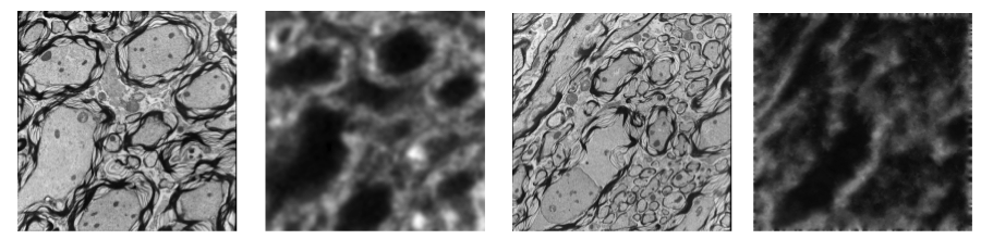 Image analogies: Training TEM (left) and confocal (second from left). Input TEM (second from right) and predicted output confocal image (right).